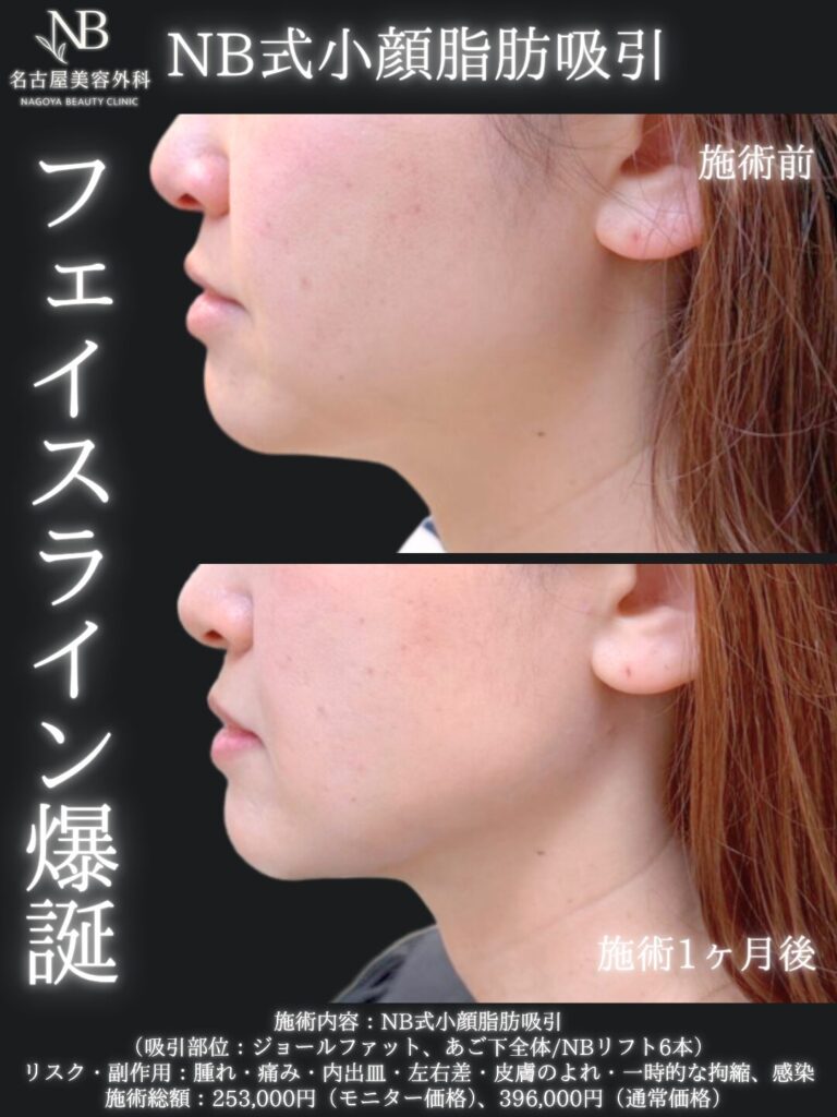 症例写真3