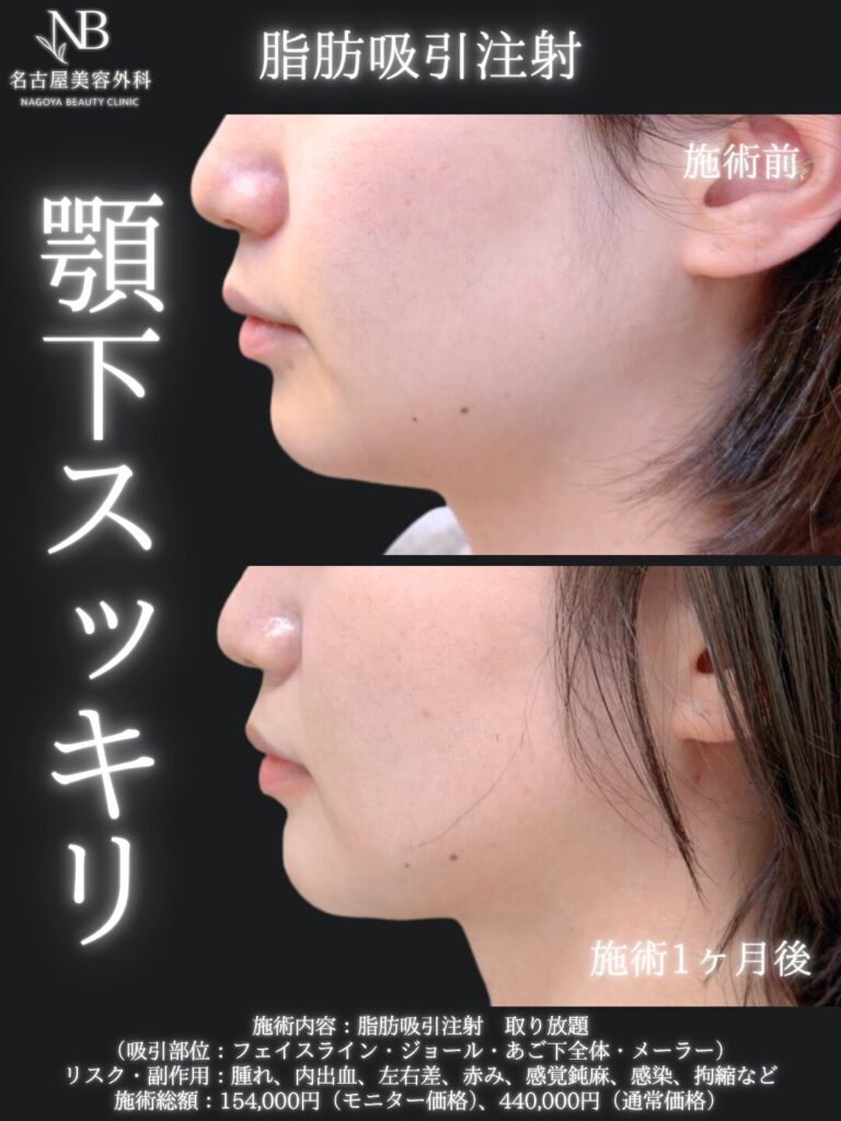 症例写真4