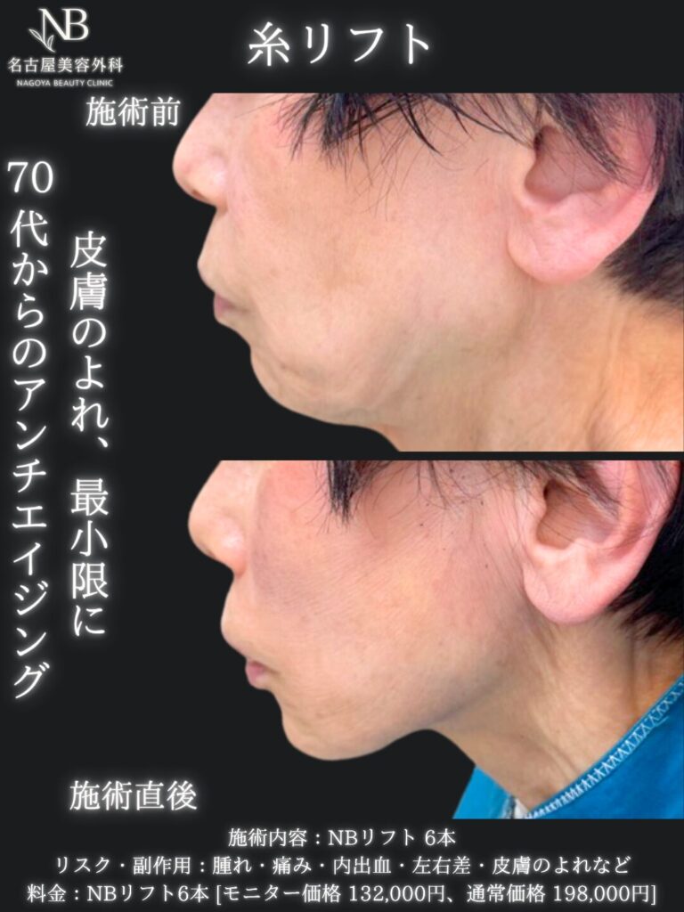 症例写真3