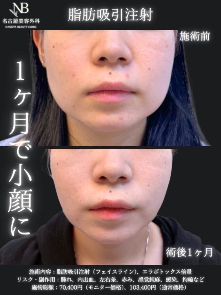 症例写真3
