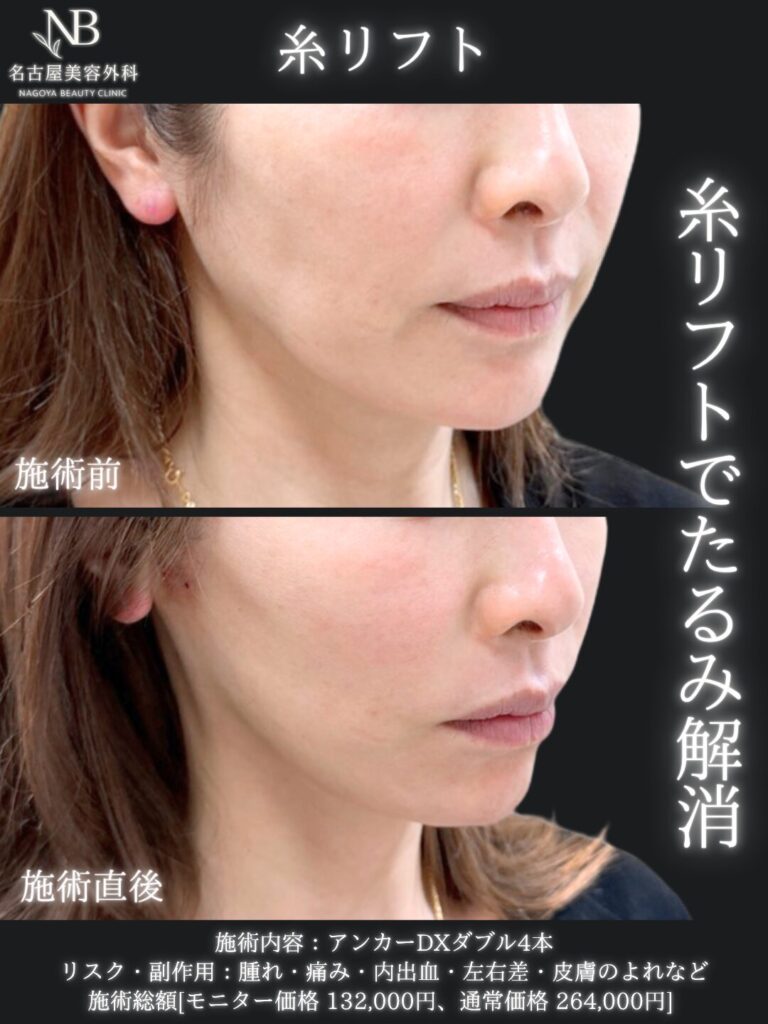 症例写真4