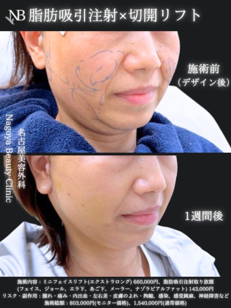 症例写真2