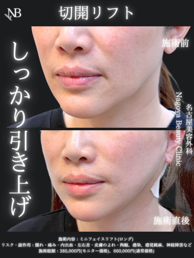 症例写真4