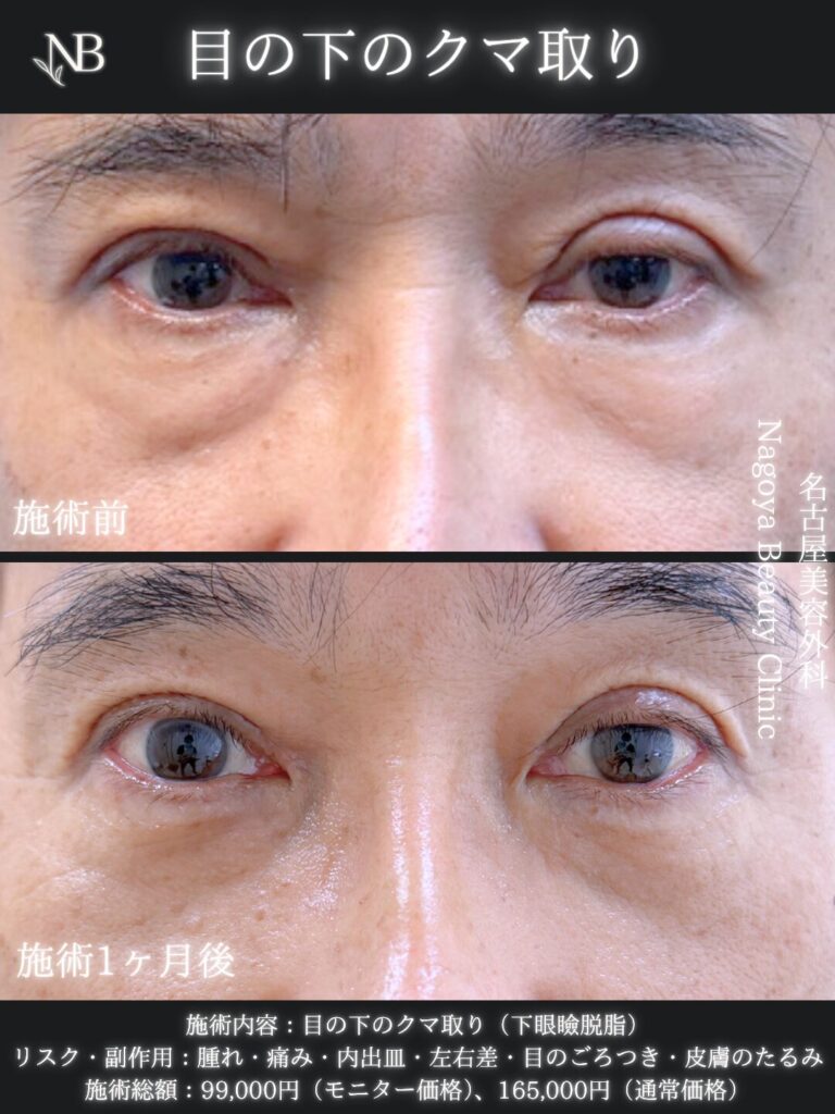 症例写真4