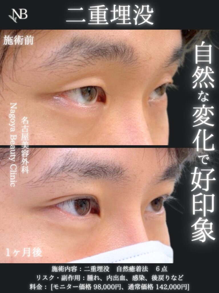 症例写真5