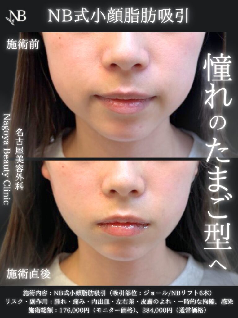 症例写真1