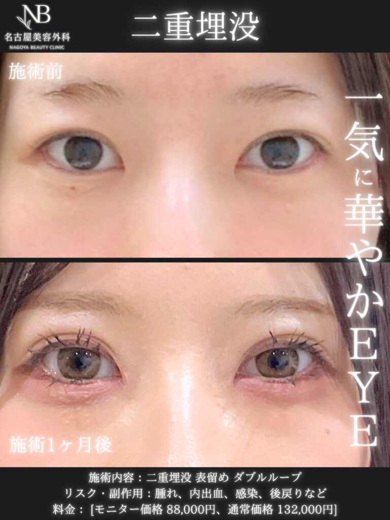 症例写真1