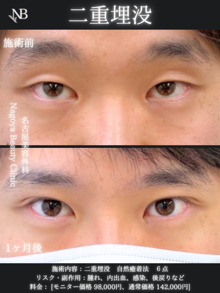 症例写真4