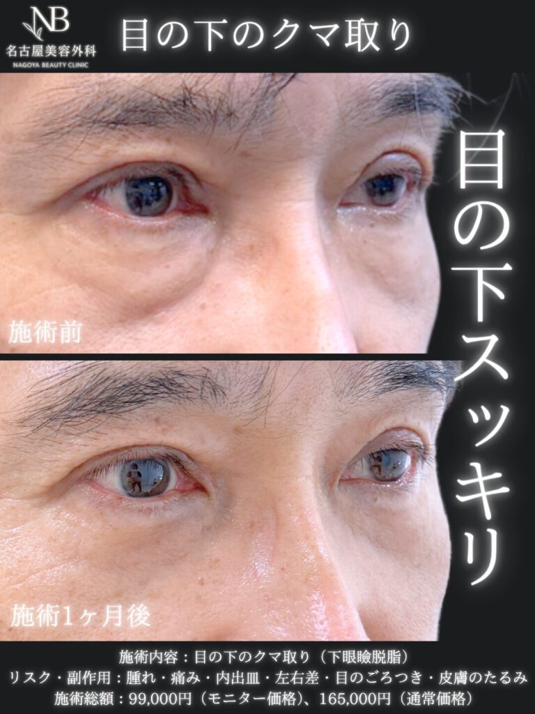症例写真1