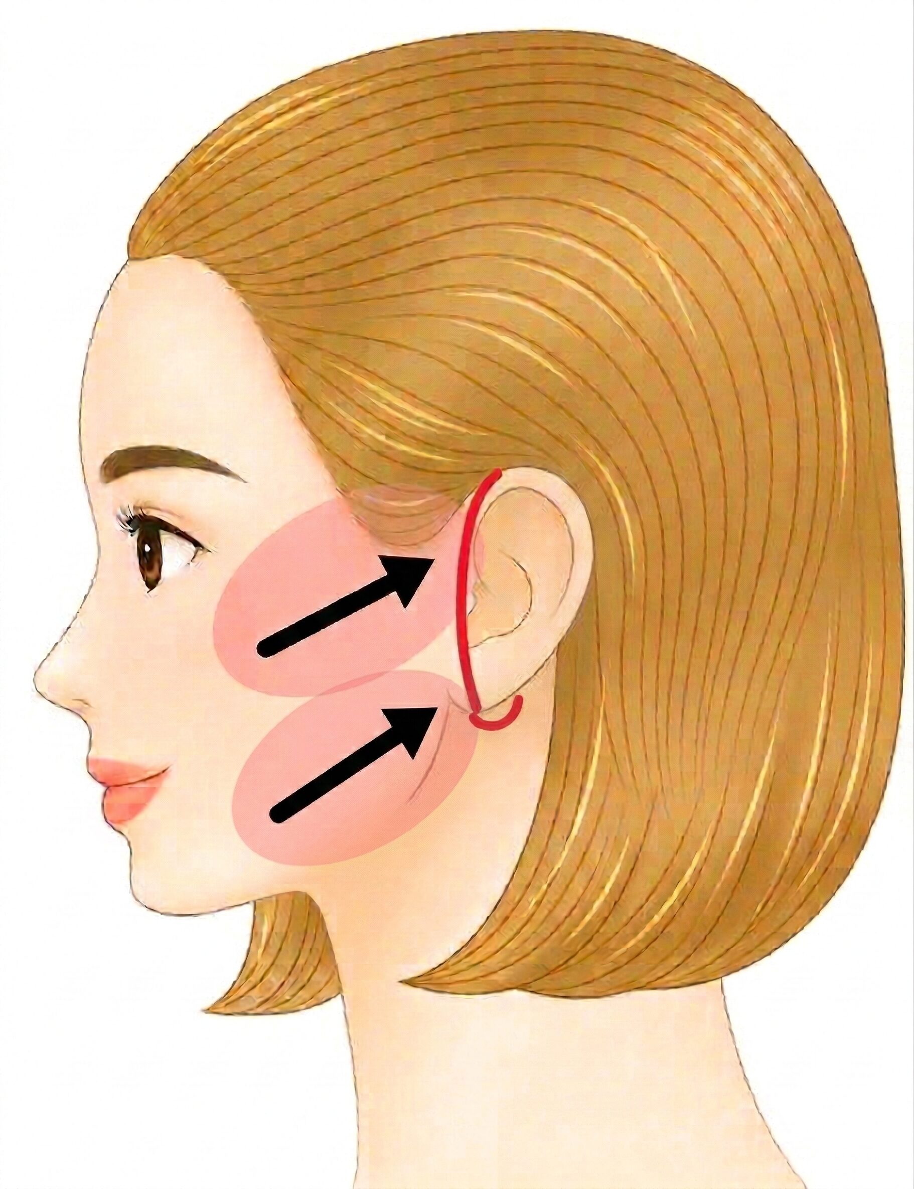 ミニフェイスリフトエクストラロング