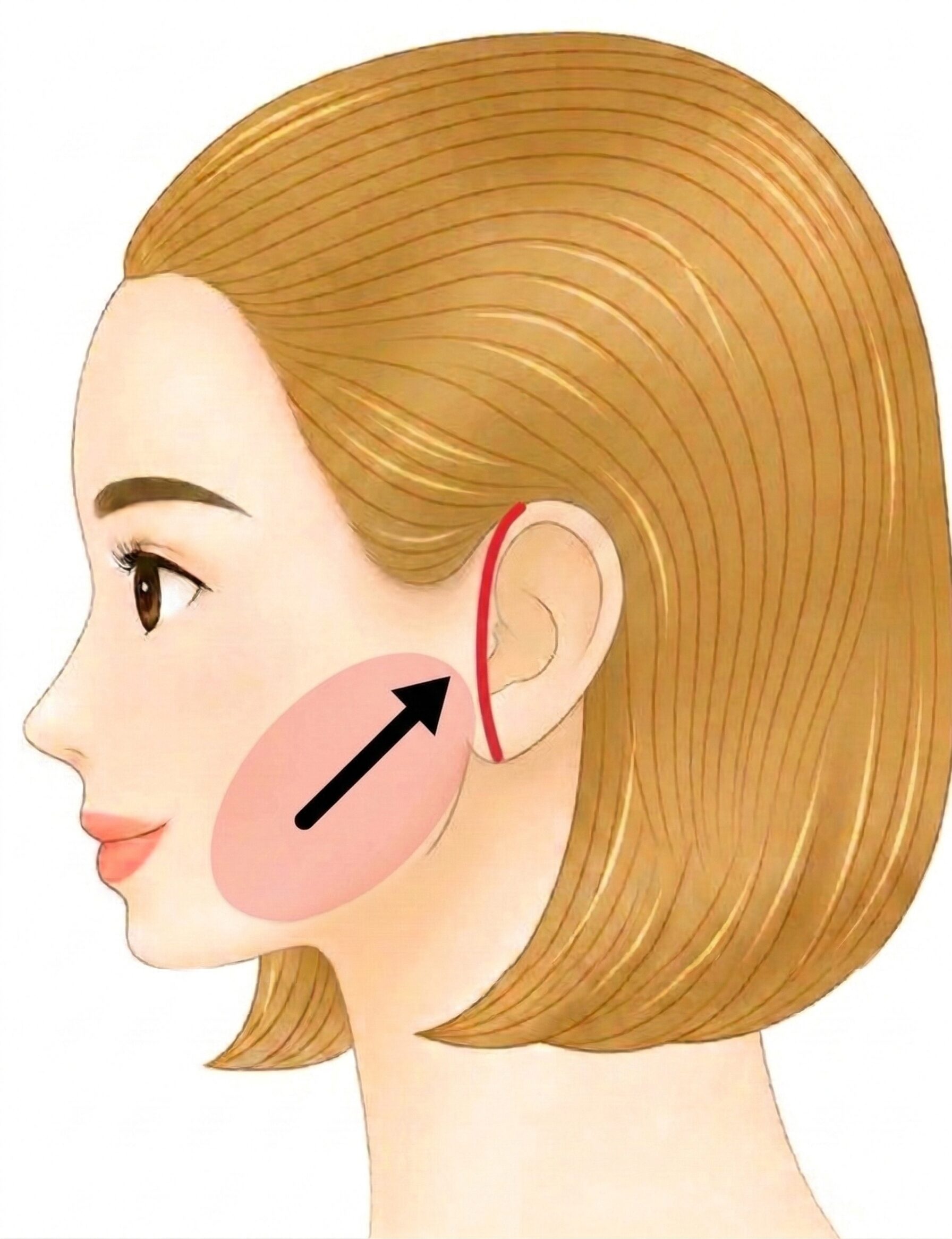 ミニフェイスリフトロング