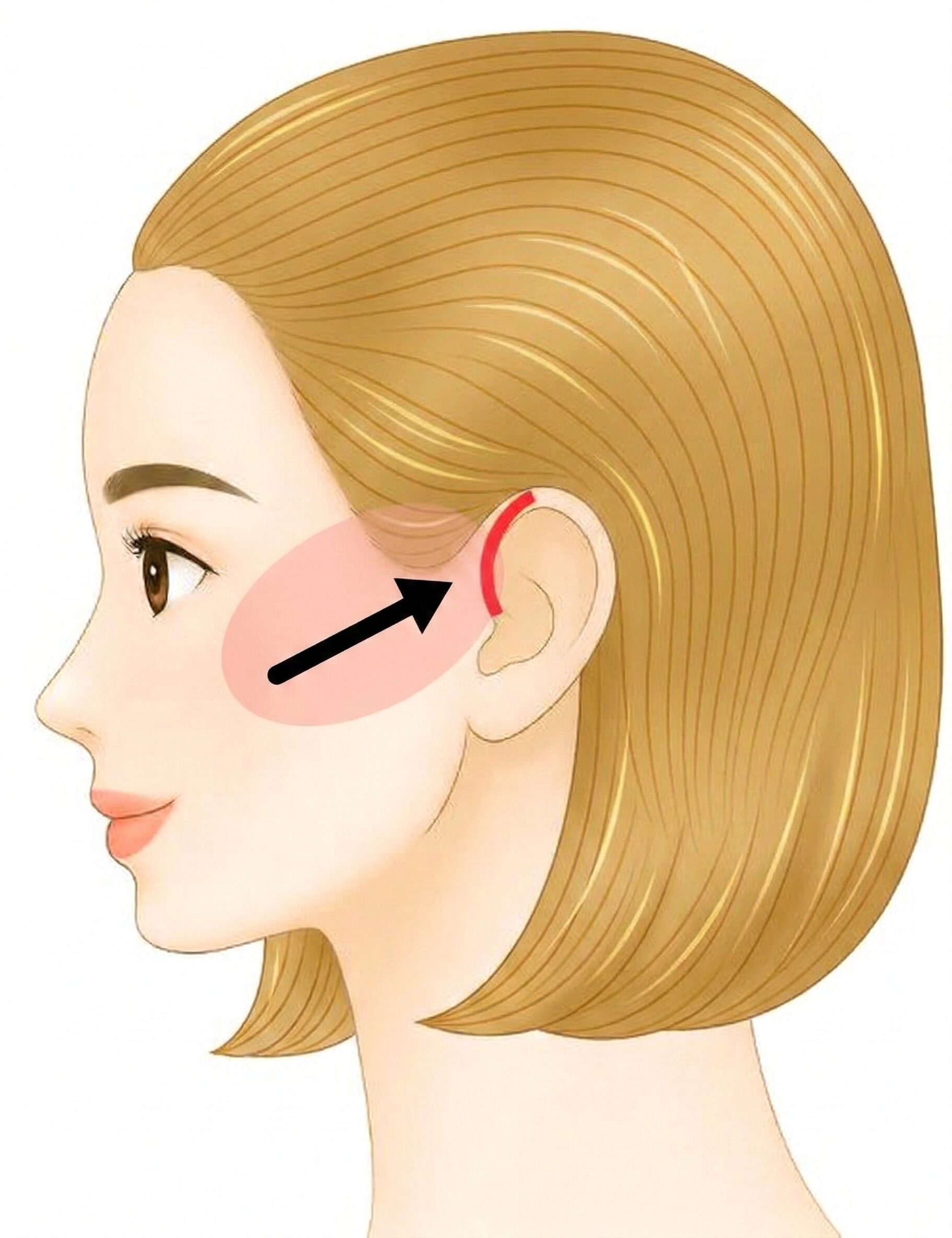 ミニフェイスリフトショート