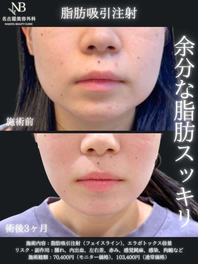症例写真3